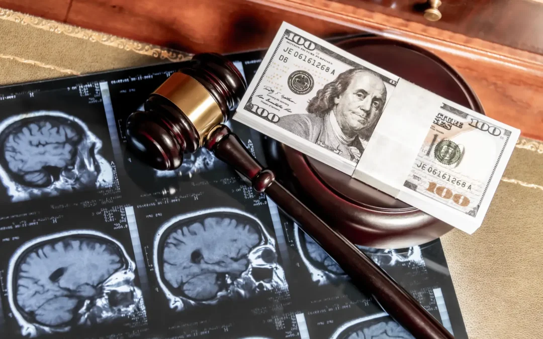 Traumatic Brain Injuries: Legal Implications and Compensation Claims